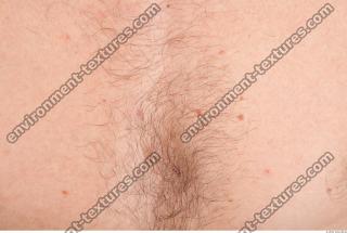 human skin hairy 0018